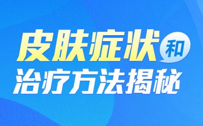 连翘败毒丸可以治疗毛囊炎吗？郑州皮肤病医院为您解答